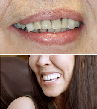 home-smile-mob-2