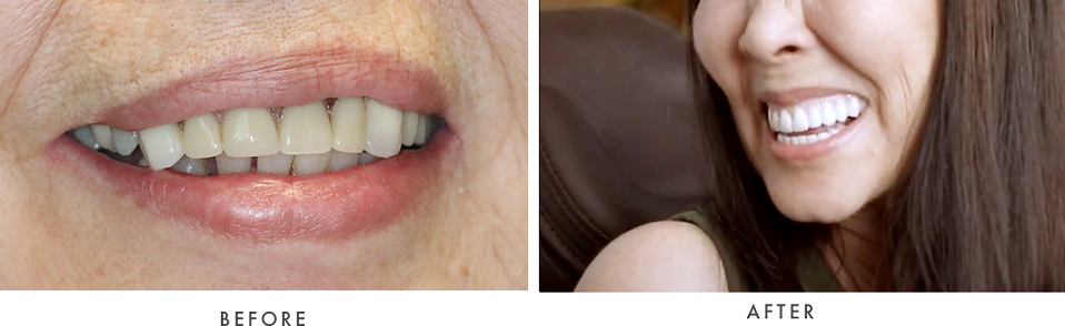 smile-2